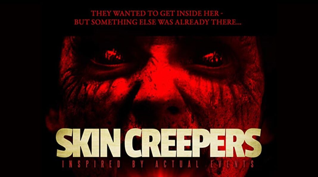 Skin Creepers