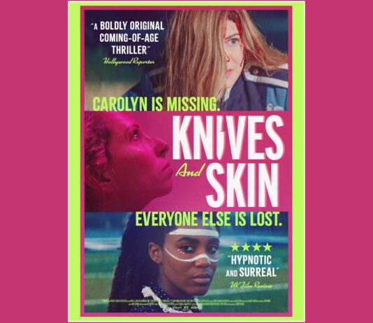 kives and skin trailer
